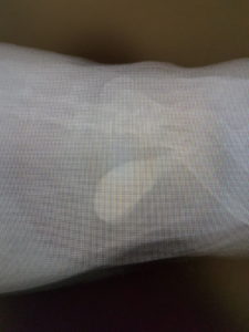 Calcificación en la vejiga de un conejo